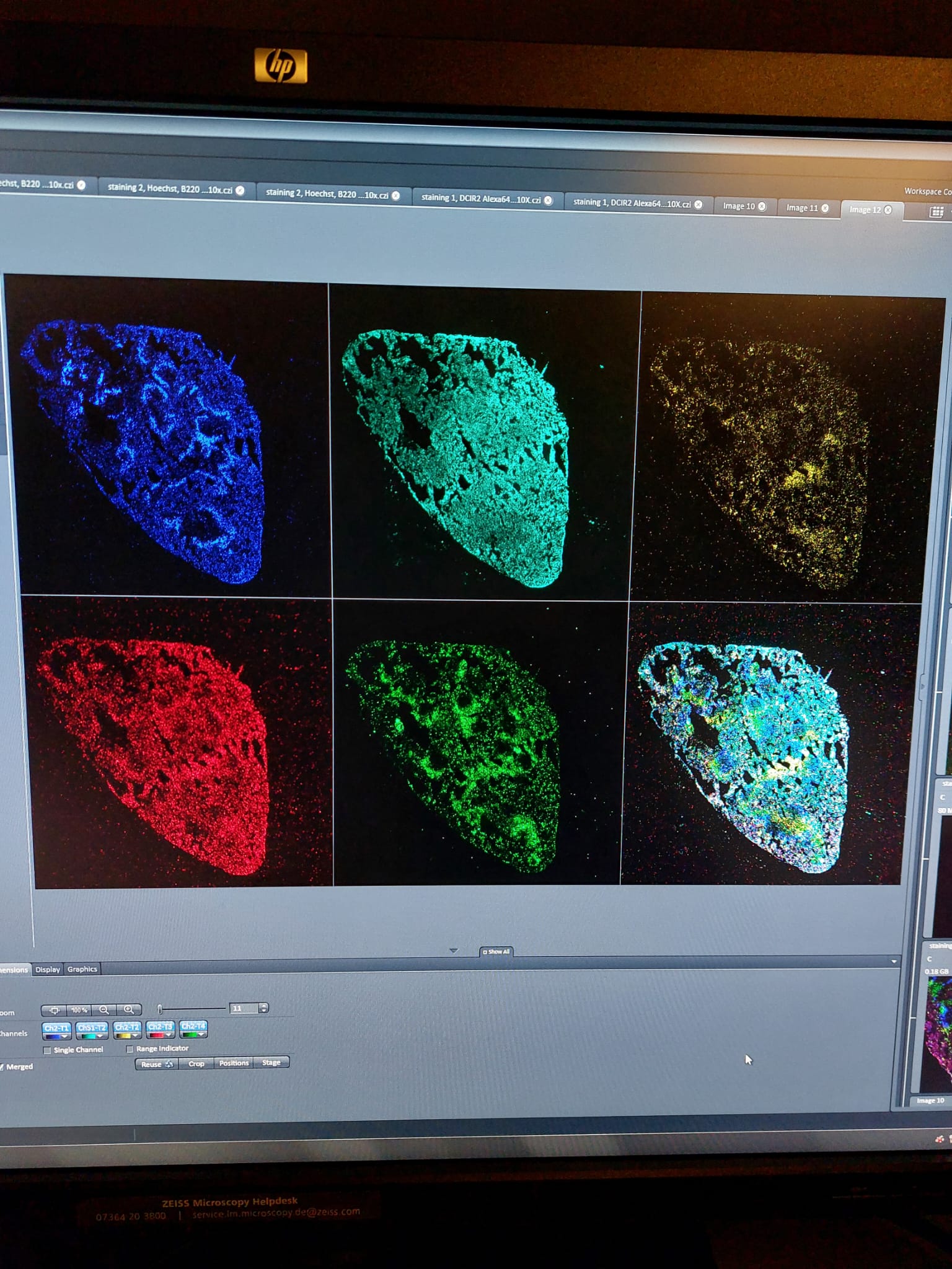 Microscopic pictures of stained spleen tissue.